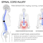 First-Line-Treatments-for-Central-Neuropathic-Pain-